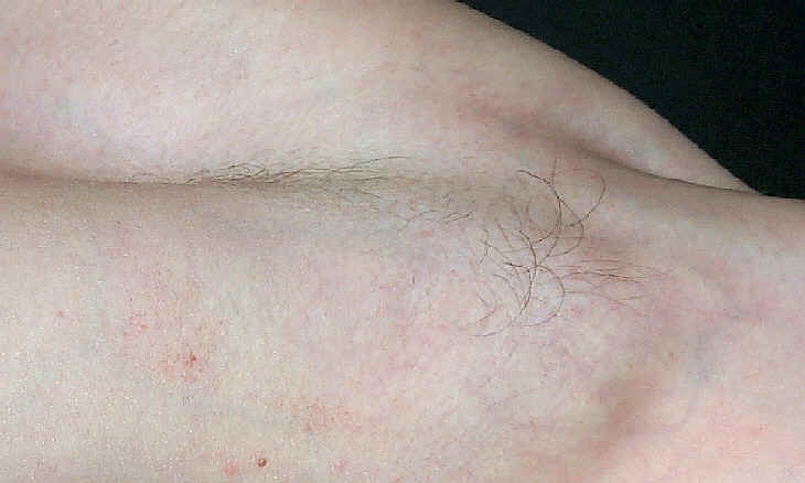 Left armpit